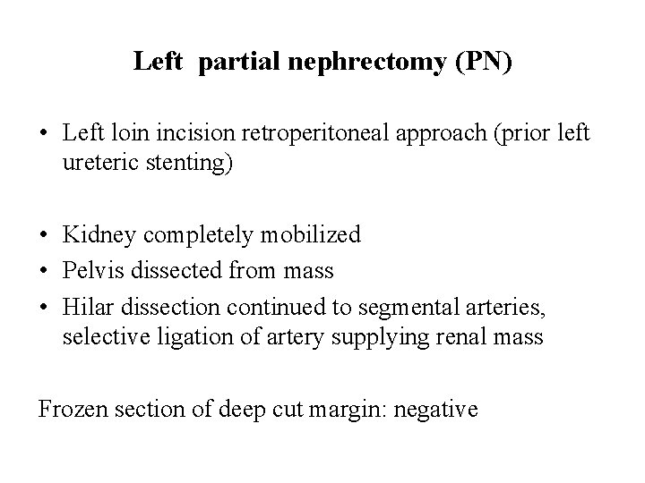 Left partial nephrectomy (PN) • Left loin incision retroperitoneal approach (prior left ureteric stenting)