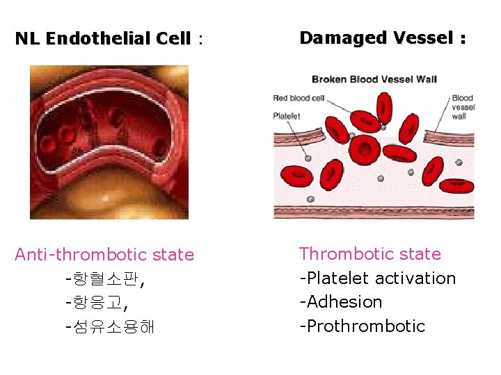 NL Endothelial Cell : Damaged Vessel : Anti-thrombotic state -항혈소판, -항응고, -섬유소용해 Thrombotic state