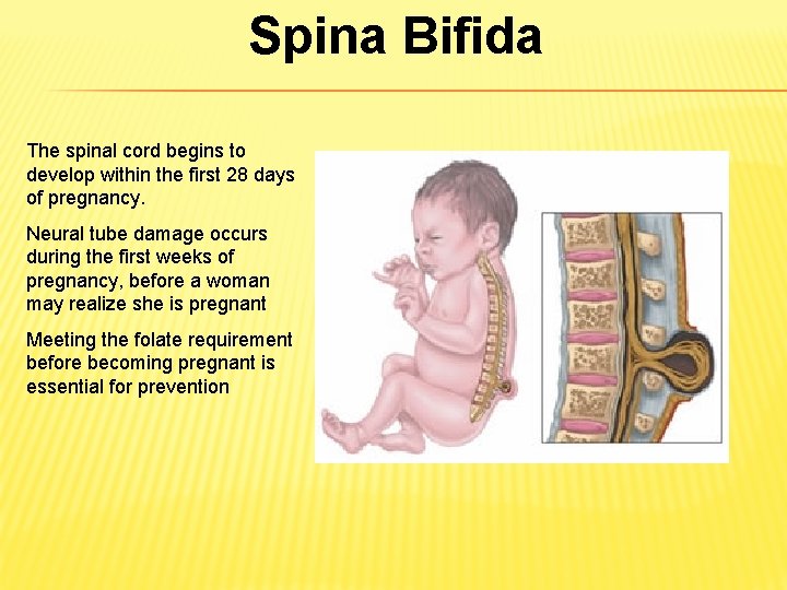 Spina Bifida The spinal cord begins to develop within the first 28 days of