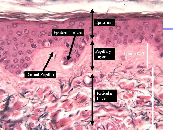 Epidermis Epidermal ridge Papillary Layer Dermal Papillae Reticular Layer 13 