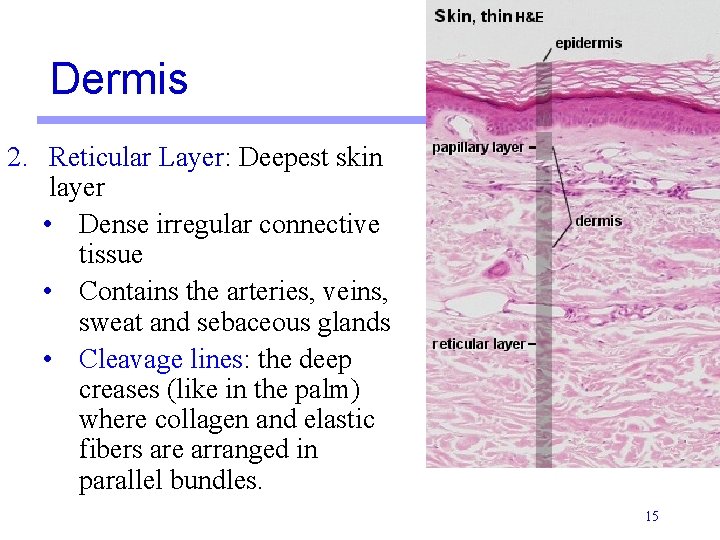 Dermis 2. Reticular Layer: Deepest skin layer • Dense irregular connective tissue • Contains