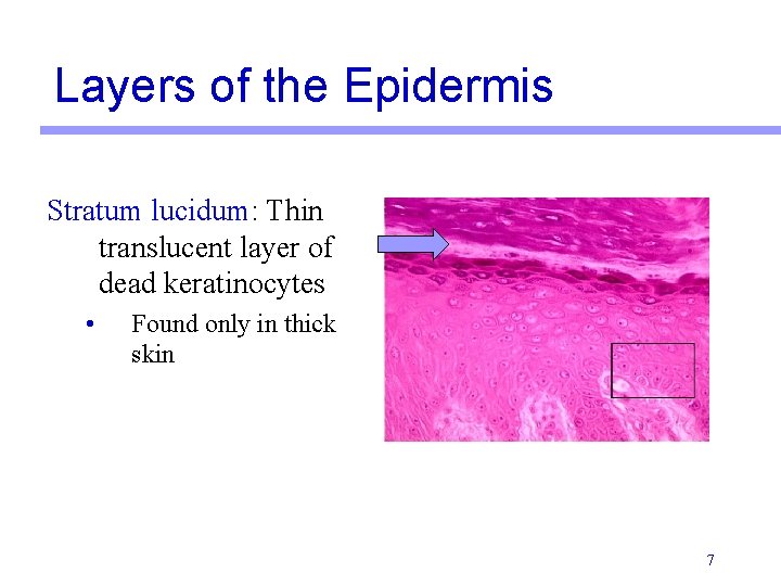 Layers of the Epidermis Stratum lucidum: Thin translucent layer of dead keratinocytes • Found