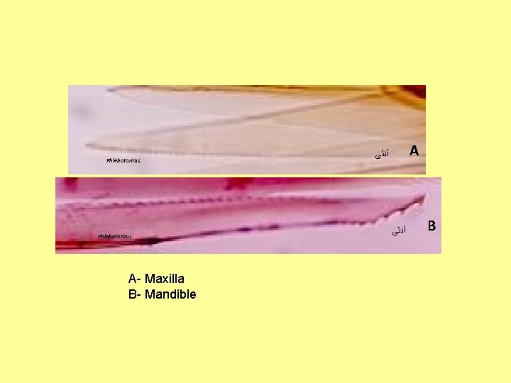 Phlebotomus A- Maxilla B- Mandible A ﺃﻨﺜﻰ B 