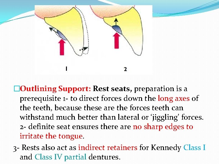 �Outlining Support: Rest seats, preparation is a prerequisite 1 - to direct forces down