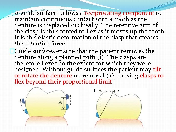 �A guide surface* allows a reciprocating component to maintain continuous contact with a tooth