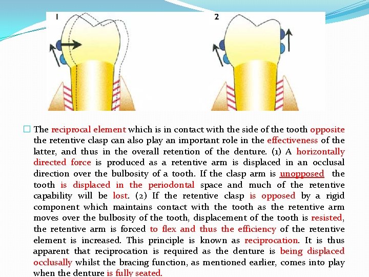 � The reciprocal element which is in contact with the side of the tooth