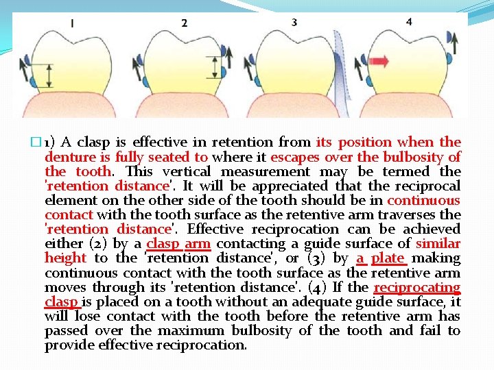 � 1) A clasp is effective in retention from its position when the denture
