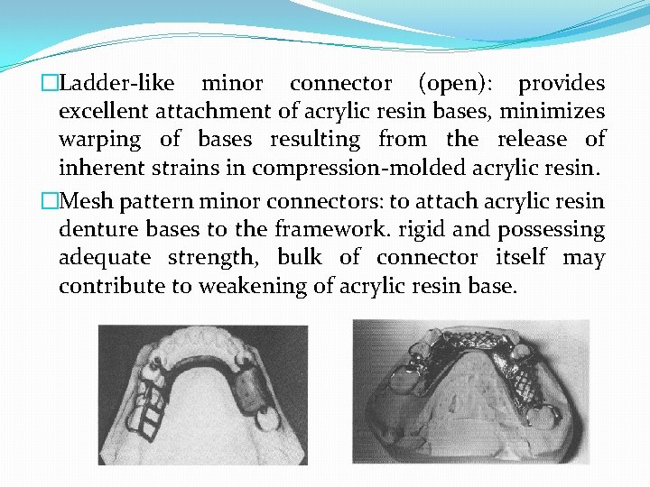 �Ladder-like minor connector (open): provides excellent attachment of acrylic resin bases, minimizes warping of