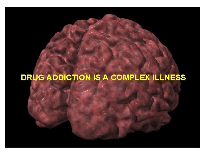 DRUG ADDICTION IS A COMPLEX ILLNESS 
