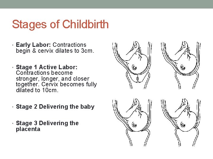 Stages of Childbirth • Early Labor: Contractions begin & cervix dilates to 3 cm.