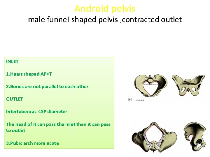Android pelvis male funnel-shaped pelvis , contracted outlet INLET 1. Heart shaped AP>T 2.
