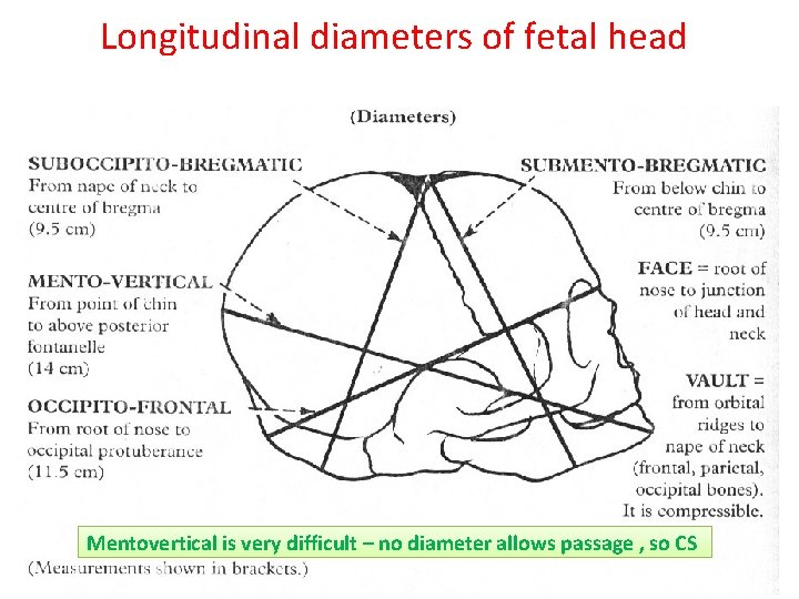 Longitudinal diameters of fetal head Mentovertical is very difficult – no diameter allows passage