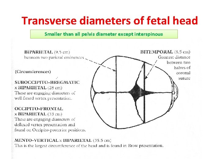 Transverse diameters of fetal head Smaller than all pelvis diameter except interspinous 