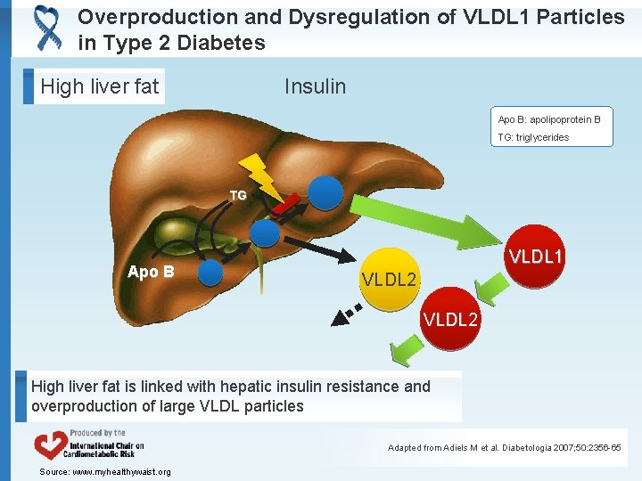 Overproduction and Dysregulation of VLDL 1 Particles in Type 2 Diabetes Insulin High liver