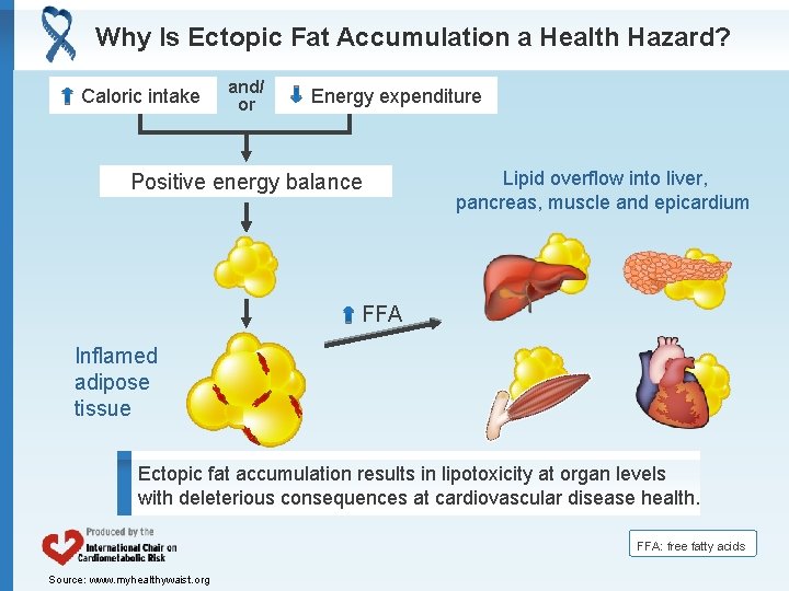 Why Is Ectopic Fat Accumulation a Health Hazard? Caloric intake and/ or Energy expenditure