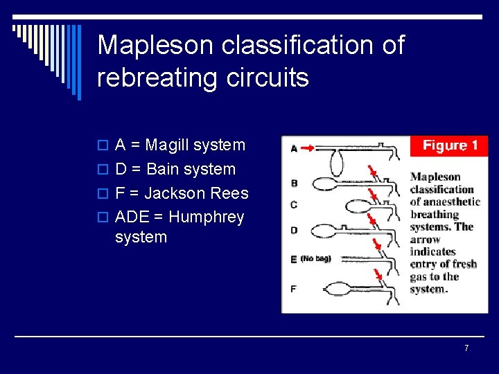 Mapleson classification of rebreating circuits o A = Magill system o D = Bain