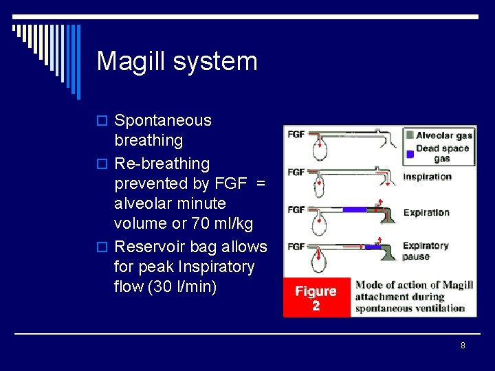 Magill system o Spontaneous breathing o Re-breathing prevented by FGF = alveolar minute volume