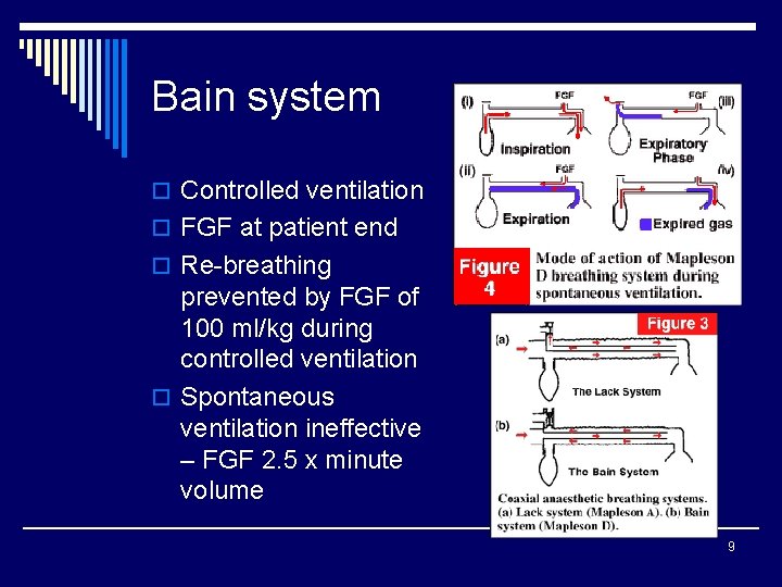 Bain system o Controlled ventilation o FGF at patient end o Re-breathing prevented by