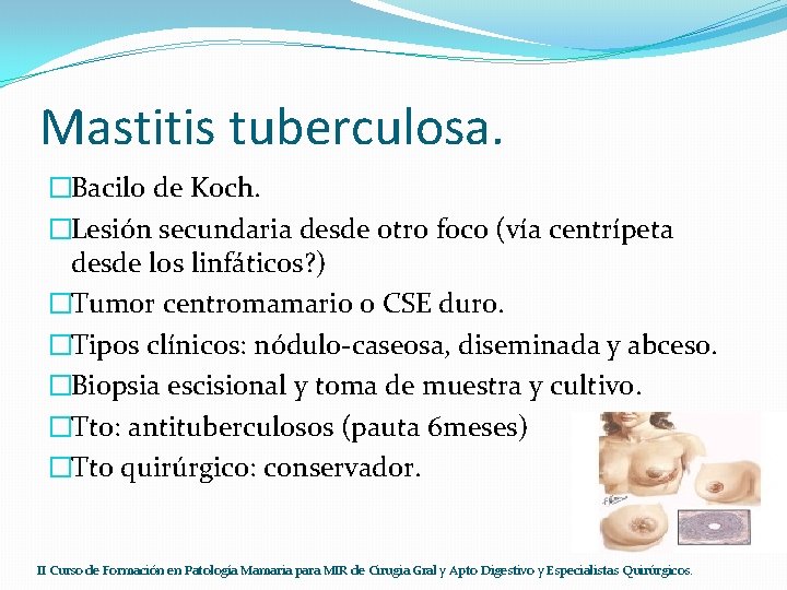 Mastitis tuberculosa. �Bacilo de Koch. �Lesión secundaria desde otro foco (vía centrípeta desde los