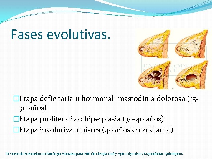 Fases evolutivas. �Etapa deficitaria u hormonal: mastodinia dolorosa (1530 años) �Etapa proliferativa: hiperplasia (30