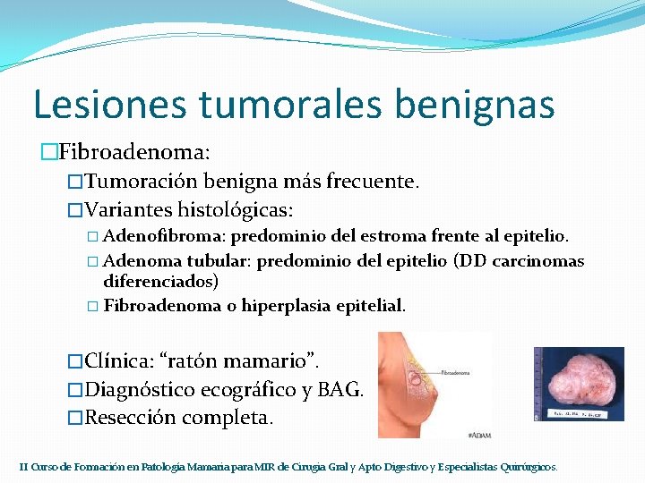 Lesiones tumorales benignas �Fibroadenoma: �Tumoración benigna más frecuente. �Variantes histológicas: � Adenofibroma: predominio del