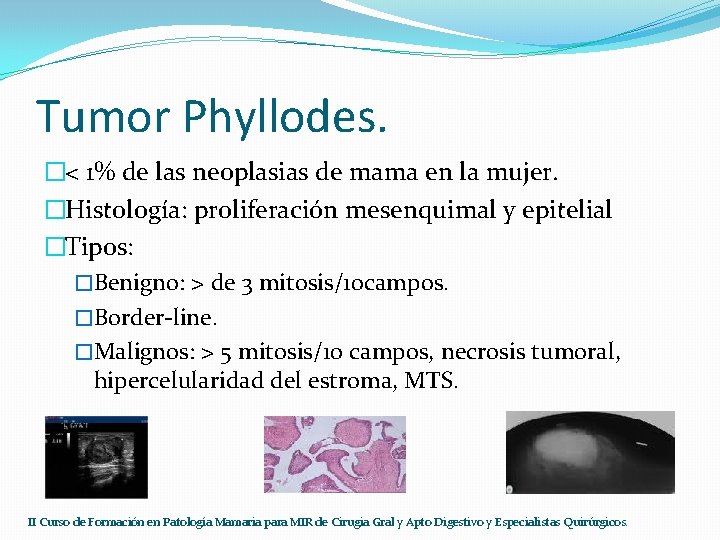 Tumor Phyllodes. �< 1% de las neoplasias de mama en la mujer. �Histología: proliferación