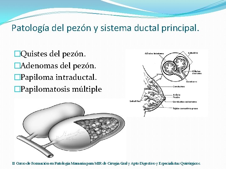Patología del pezón y sistema ductal principal. �Quistes del pezón. �Adenomas del pezón. �Papiloma