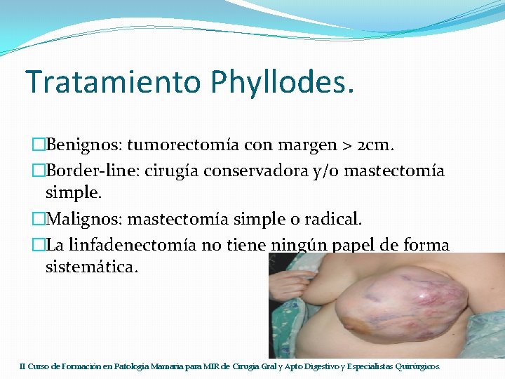 Tratamiento Phyllodes. �Benignos: tumorectomía con margen > 2 cm. �Border-line: cirugía conservadora y/o mastectomía