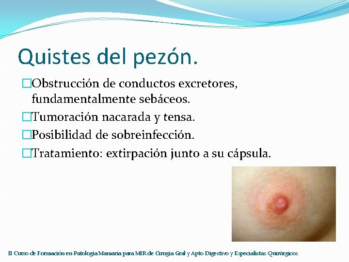 Quistes del pezón. �Obstrucción de conductos excretores, fundamentalmente sebáceos. �Tumoración nacarada y tensa. �Posibilidad