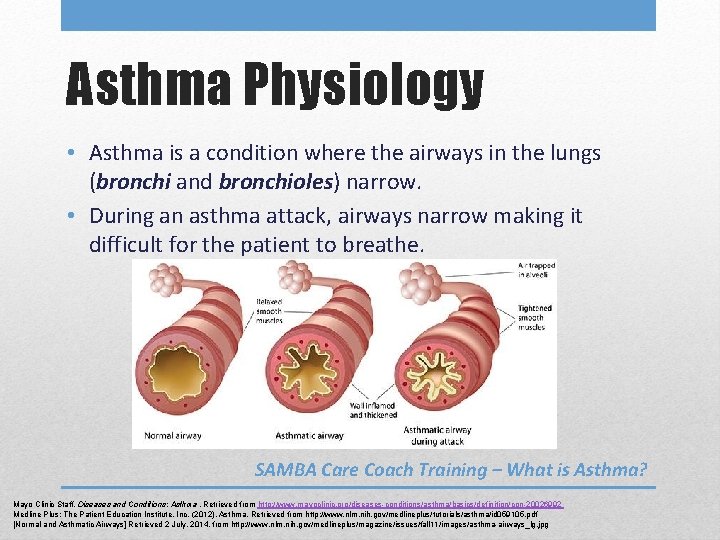 Asthma Physiology • Asthma is a condition where the airways in the lungs (bronchi