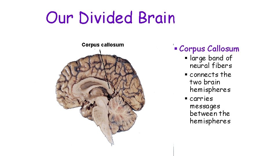 Our Divided Brain Corpus callosum § Corpus Callosum § large band of neural fibers