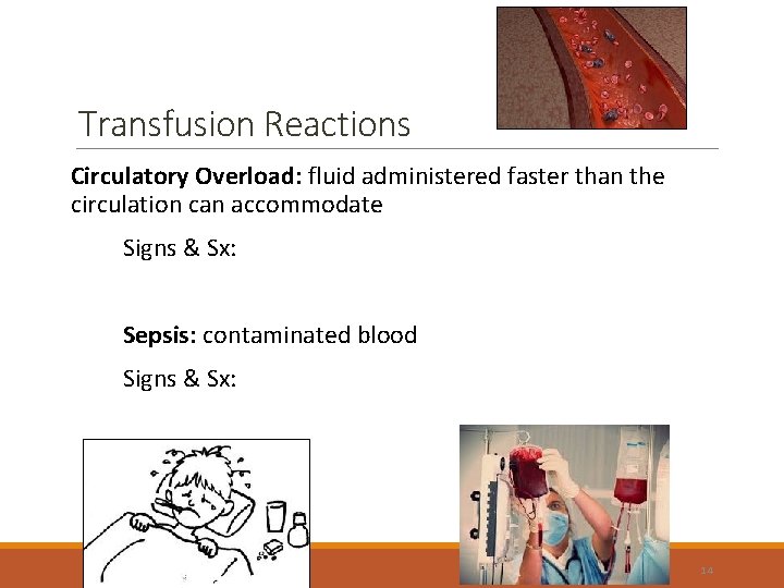 Transfusion Reactions Circulatory Overload: fluid administered faster than the circulation can accommodate Signs &
