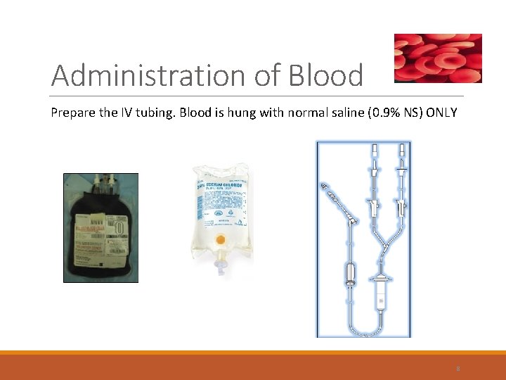 Administration of Blood Prepare the IV tubing. Blood is hung with normal saline (0.