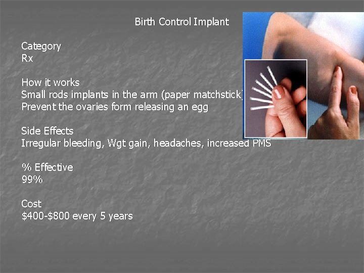 Birth Control Implant Category Rx How it works Small rods implants in the arm