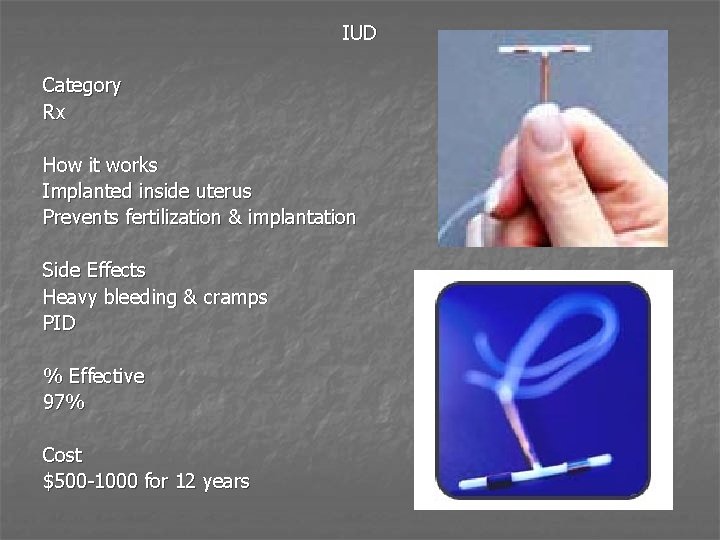 IUD Category Rx How it works Implanted inside uterus Prevents fertilization & implantation Side