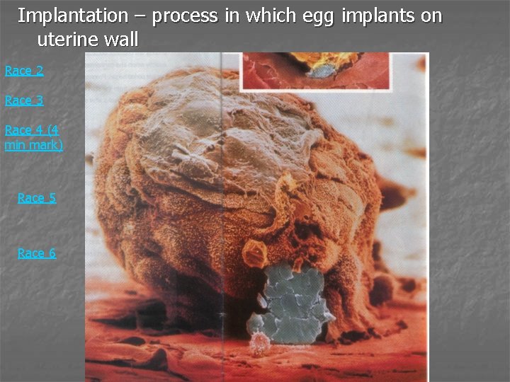 Implantation – process in which egg implants on uterine wall Race 2 Race 3