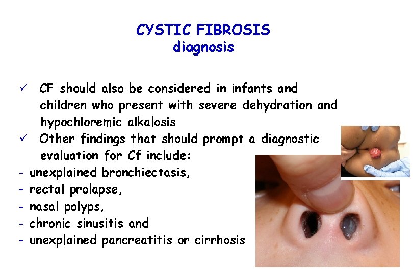 CYSTIC FIBROSIS diagnosis ü CF should also be considered in infants and children who