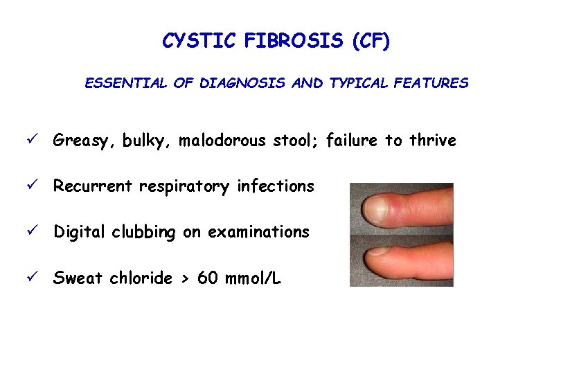 CYSTIC FIBROSIS (CF) ESSENTIAL OF DIAGNOSIS AND TYPICAL FEATURES ü Greasy, bulky, malodorous stool;