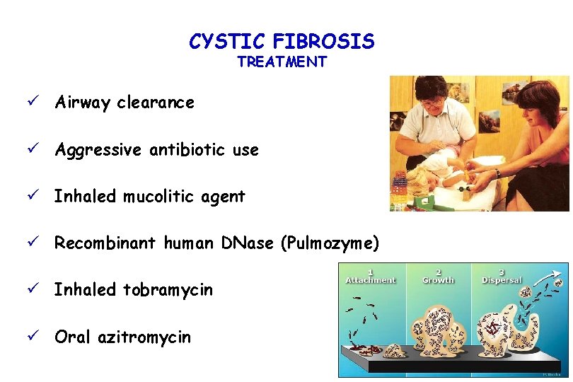 CYSTIC FIBROSIS TREATMENT ü Airway clearance ü Aggressive antibiotic use ü Inhaled mucolitic agent