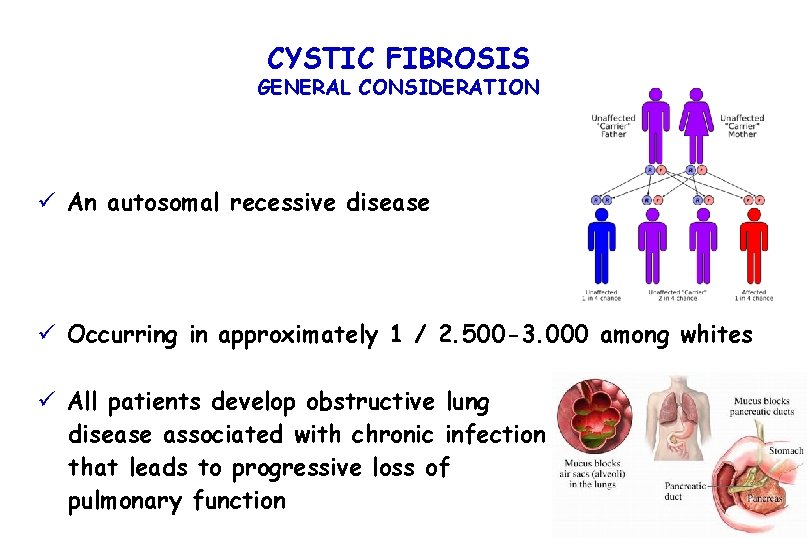 CYSTIC FIBROSIS GENERAL CONSIDERATION ü An autosomal recessive disease ü Occurring in approximately 1