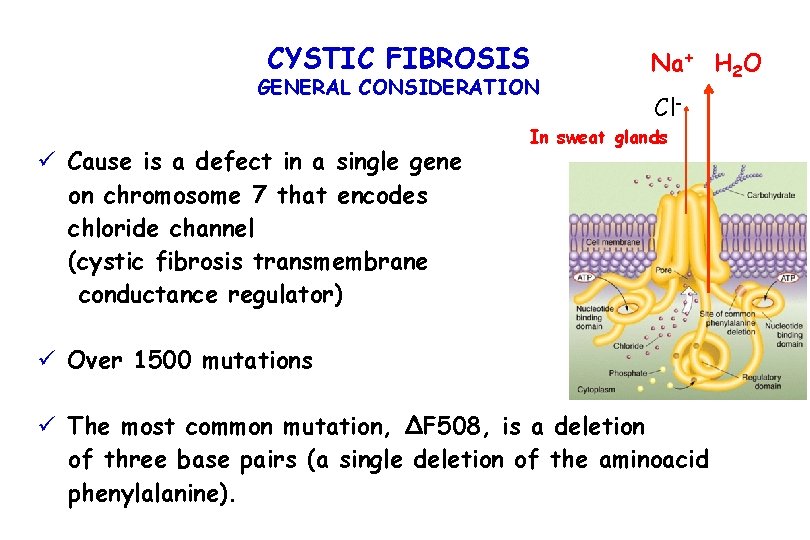 CYSTIC FIBROSIS GENERAL CONSIDERATION ü Cause is a defect in a single gene on