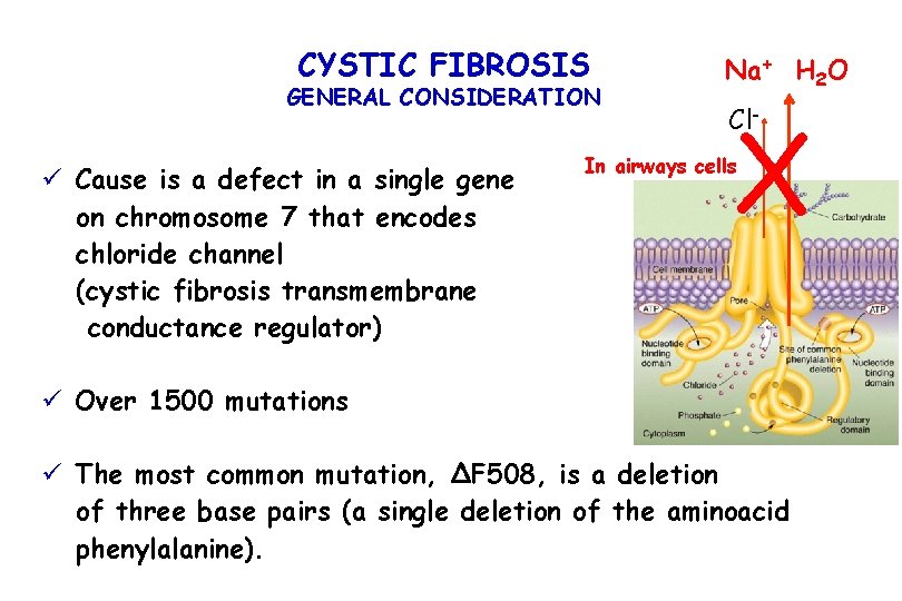 CYSTIC FIBROSIS GENERAL CONSIDERATION ü Cause is a defect in a single gene on