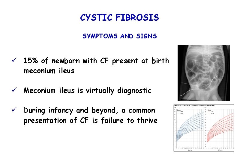 CYSTIC FIBROSIS SYMPTOMS AND SIGNS ü 15% of newborn with CF present at birth