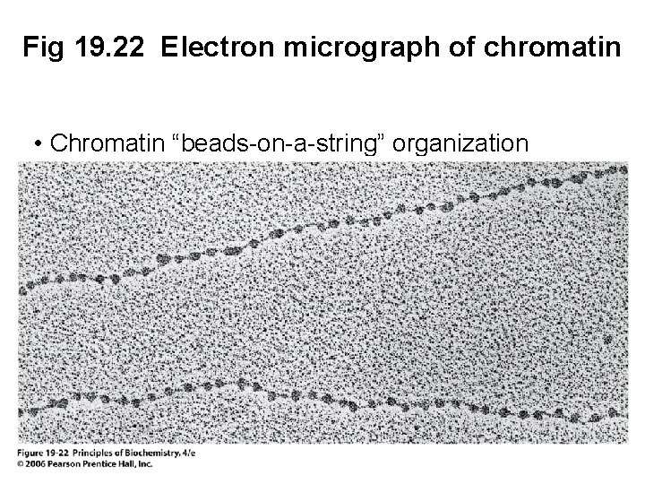 Fig 19. 22 Electron micrograph of chromatin • Chromatin “beads-on-a-string” organization 
