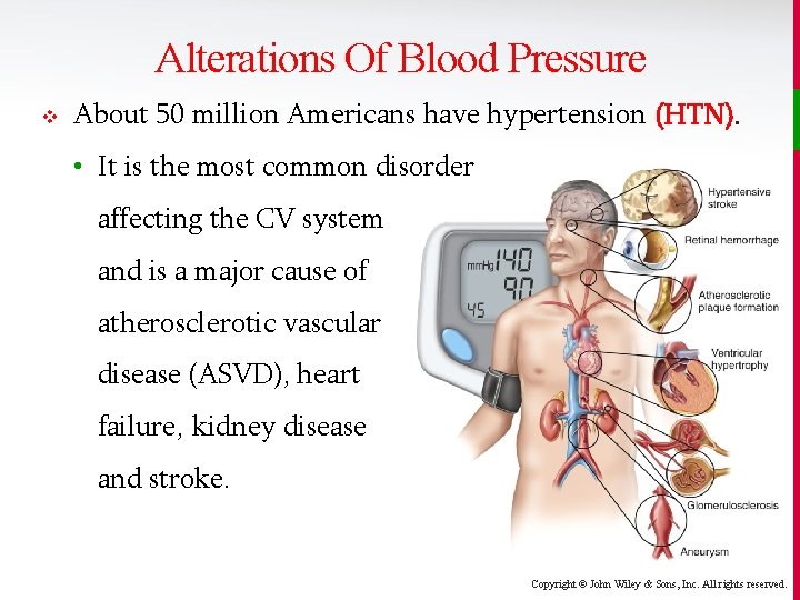 Alterations Of Blood Pressure v About 50 million Americans have hypertension (HTN). • It