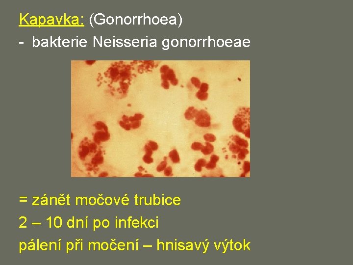 Kapavka: (Gonorrhoea) - bakterie Neisseria gonorrhoeae = zánět močové trubice 2 – 10 dní