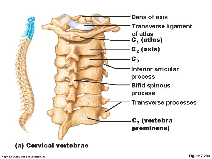 Dens of axis Transverse ligament of atlas C 1 (atlas) C 2 (axis) C