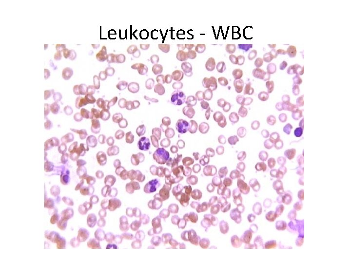 Leukocytes - WBC 