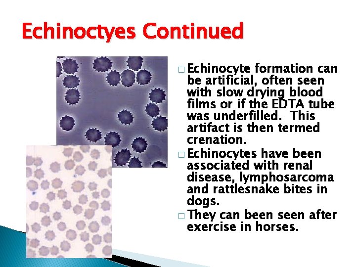 Echinoctyes Continued � Echinocyte formation can be artificial, often seen with slow drying blood