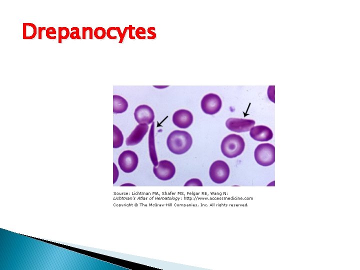 Drepanocytes 